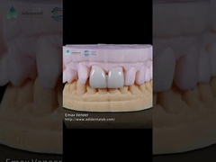 प्राकृतिक दबाया ईएमएएक्स फनीर शक्ति 16 रंग ईएमएएक्स दांत फनीर