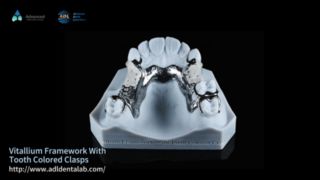 विटालियम फ्रेमवर्क प्राकृतिक सौंदर्यशास्त्र आसान फ़िट