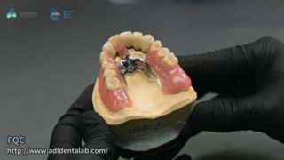 टेलीस्कोप क्राउन परिशुद्धता सोल्डरिंग गुणवत्ता