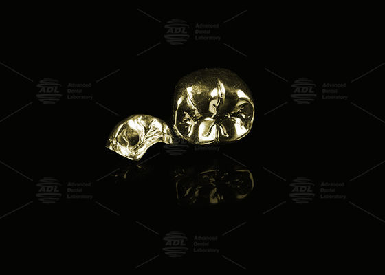 खरीदें बहुमूल्य मिश्र धातु पीला सोना 60% पूर्ण धातु मुकुट सोना खत्म पूर्ण धातु मुकुट ऑनलाइन निर्माण