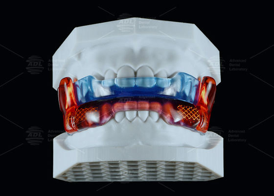 खरीदें चिकित्सा ग्रेड सिलिकॉन विरोधी खर्राटे उपकरण RP नींद में सुधार के लिए ऑनलाइन निर्माण