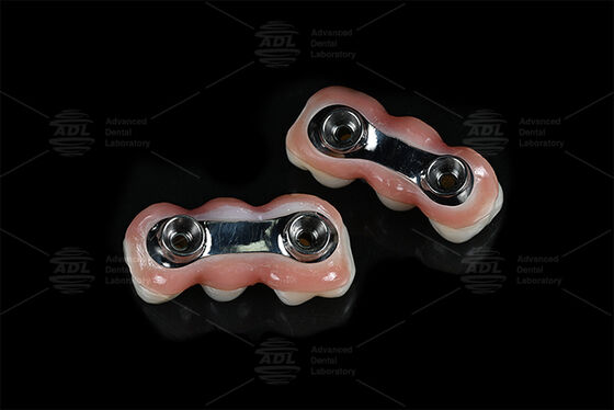 खरीदें सशक्तिकरण प्रत्यारोपण पट्टी सीएडी सीएएम सटीक फिट के लिए डिज़ाइन किया गया अधिकांश दंत प्रत्यारोपण प्रणालियों के साथ संगत दंत बहाली समाधान सुनिश्चित करना चीनी दंत प्रयोगशाला ऑनलाइन निर्माण