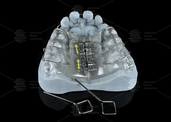 चीन डेंटल लैब रंगीन स्टेनलेस स्टील स्क्रू एक्सपेंडर मैक्सिला और मैंडिबल विस्तार के लिए